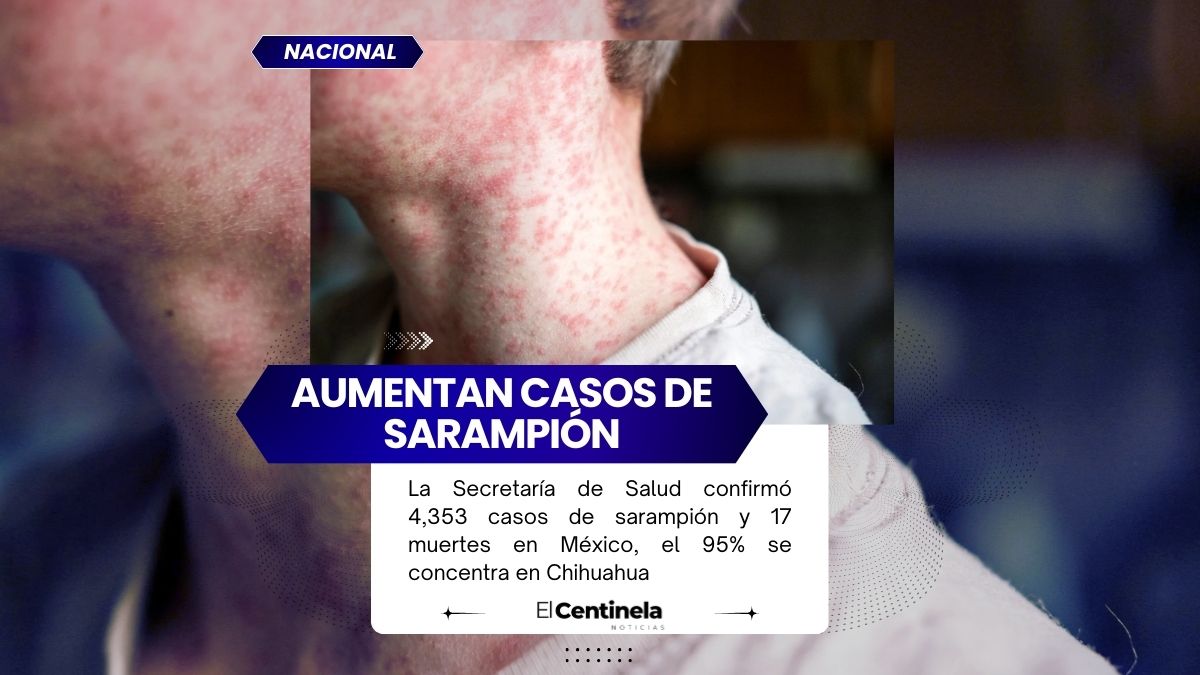 México registra 4,353 casos de sarampión y 17 muertes, alerta baja cobertura de vacunación
