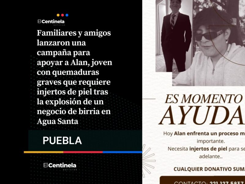 ¡Todo suma! Piden ayuda solidaria para Alan tras explosión de puesto de birria en Agua Santa