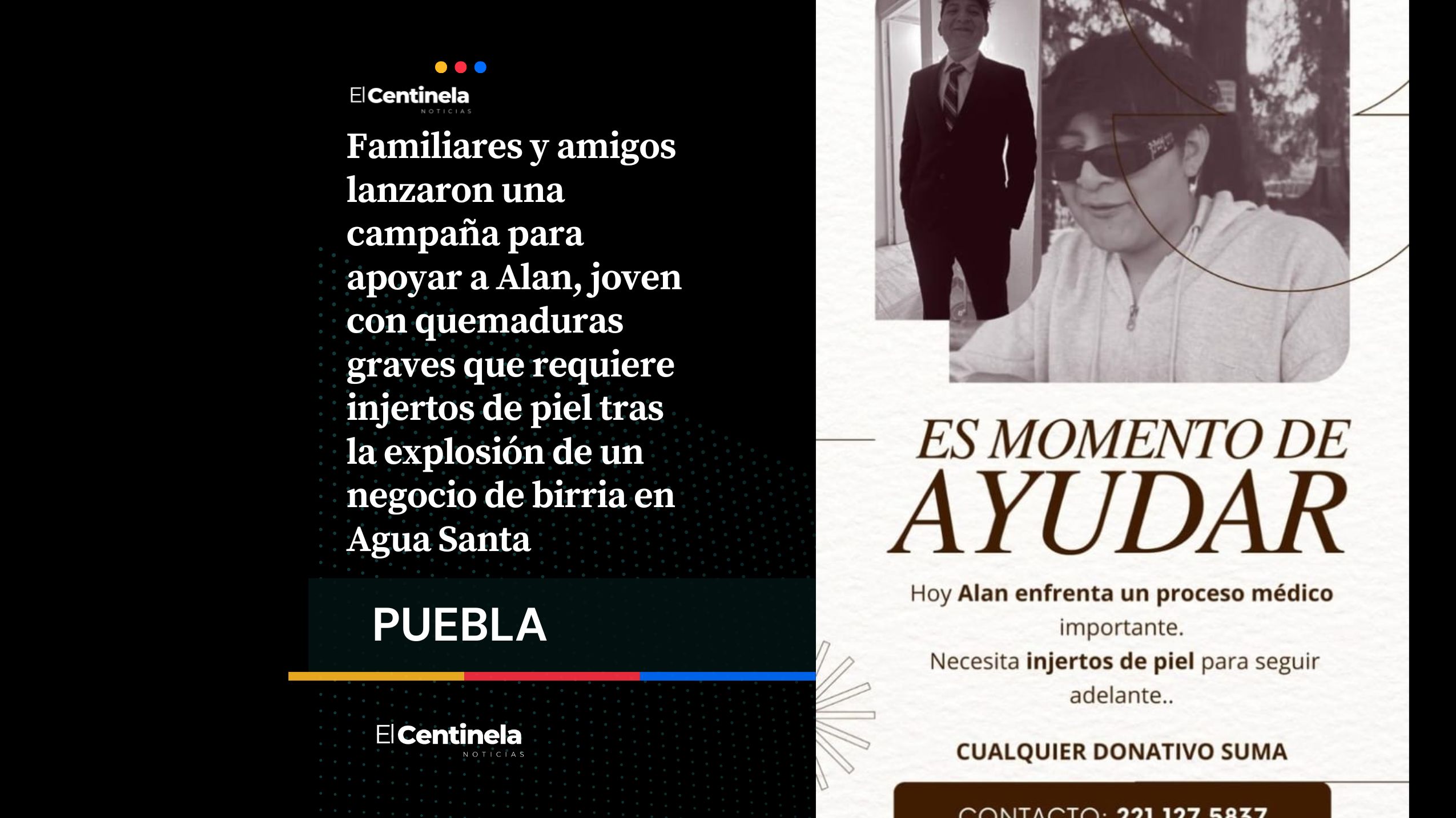 ¡Todo suma! Piden ayuda solidaria para Alan tras explosión de puesto de birria en Agua Santa