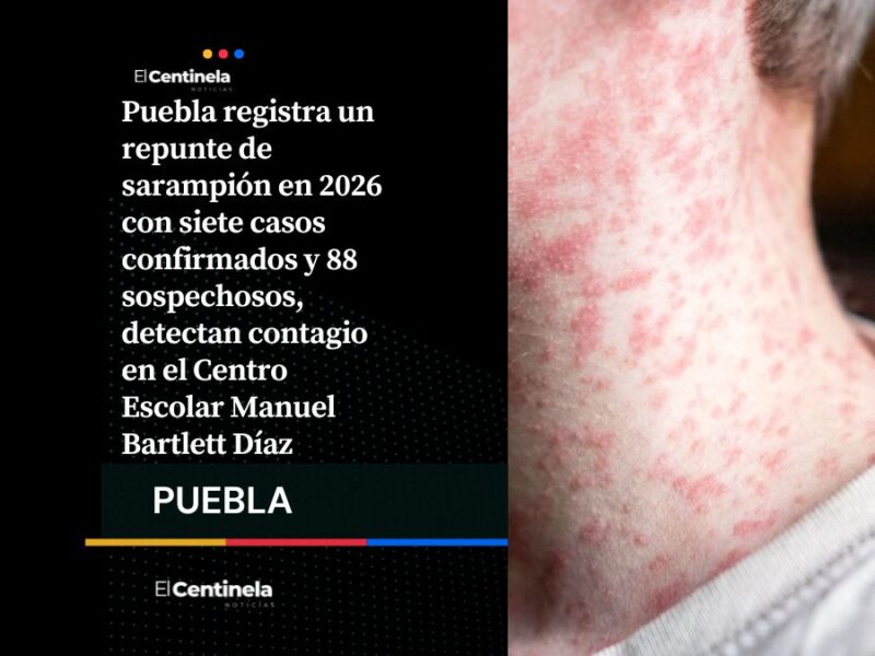 Sarampión se acelera en Puebla: confirman 7 casos y vigilan 88 sospechosos en una semana