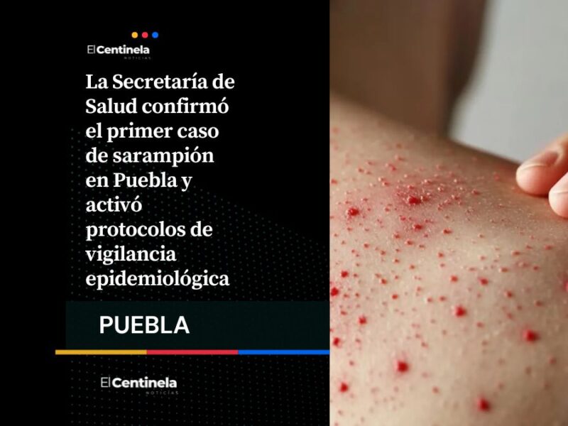 Confirman primer caso de sarampión en Puebla y activan protocolos sanitarios