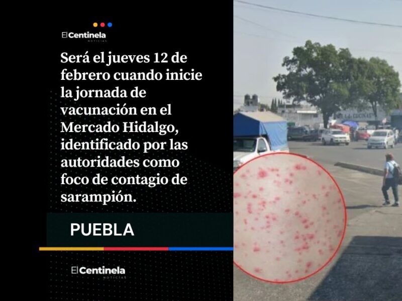 Mercado Hidalgo, foco de infección por brote de sarampión en Puebla