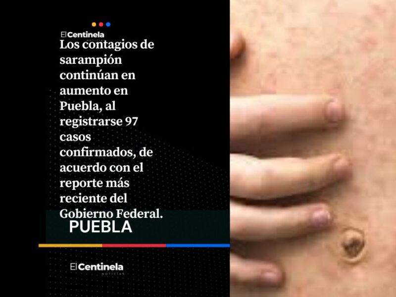 Puebla registra 97 contagios de sarampión y la cifra sigue en aumento