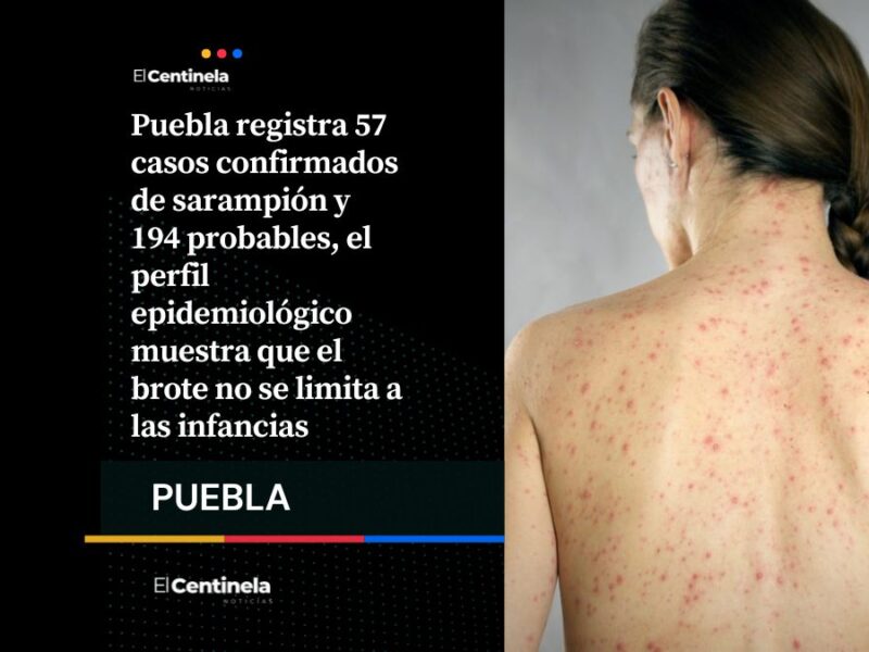 Aumenta presencia de sarampión en Puebla: suman 57 casos en 6 municipios