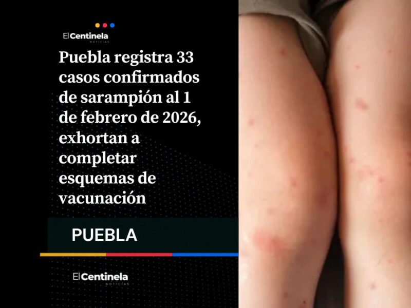 Puebla suma 33 casos confirmados de sarampión al 1 de febrero, refuerzan llamado a vacunación