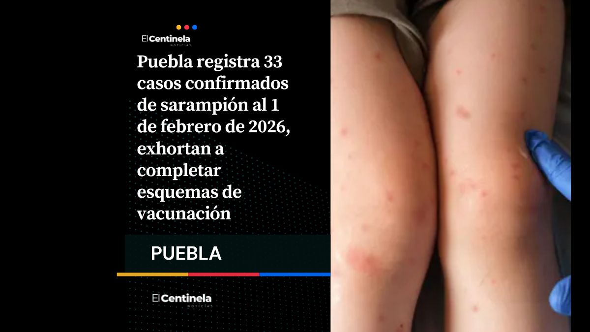 Puebla suma 33 casos confirmados de sarampión al 1 de febrero, refuerzan llamado a vacunación