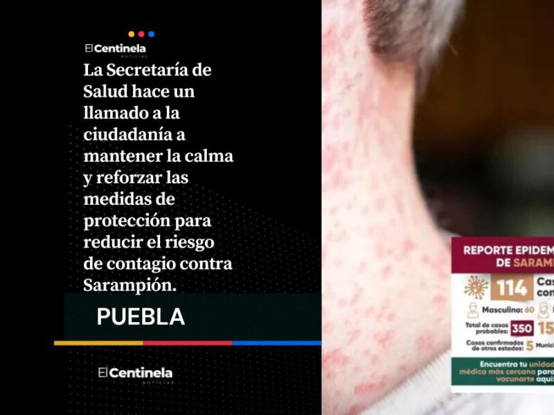 Suman 114 casos de sarampión en Puebla; hay 350 sospechosos