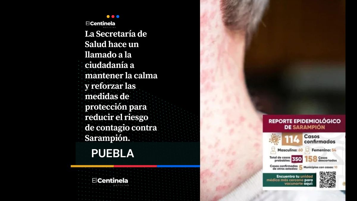 Suman 114 casos de sarampión en Puebla; hay 350 sospechosos
