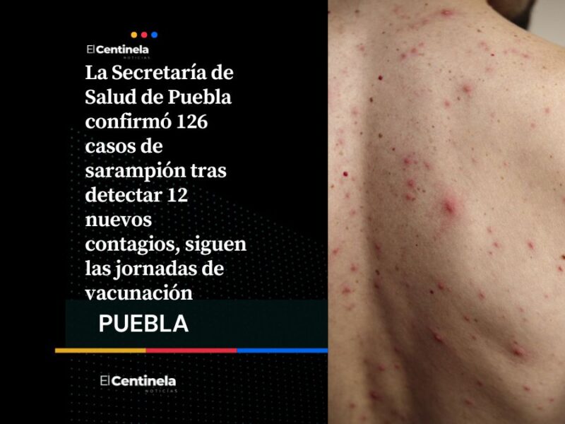 Casos de sarampión en Puebla aumentan a 126, Salud confirma 12 nuevos contagios en el estado