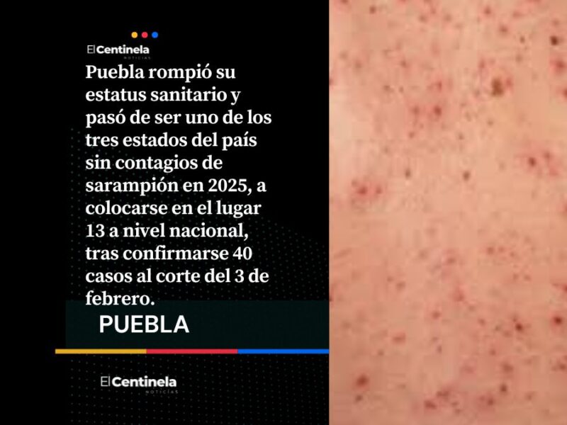 Sarampión fuera de control: Puebla suma 40 contagios en 18 días