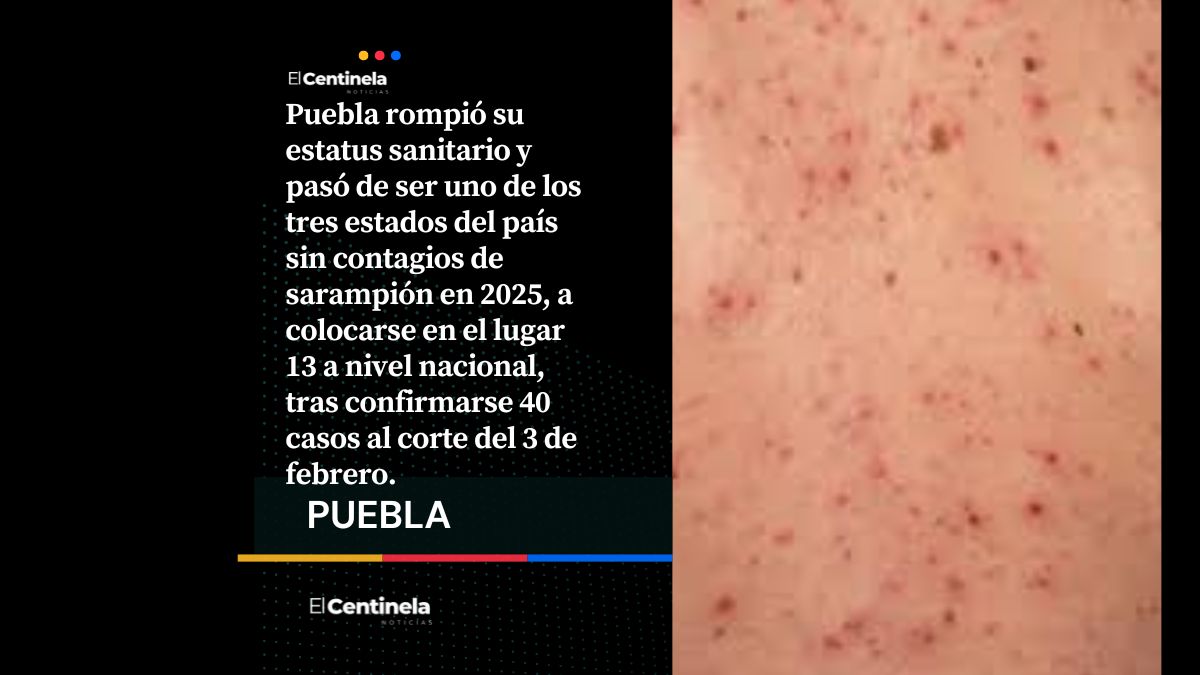 Sarampión fuera de control: Puebla suma 40 contagios en 18 días