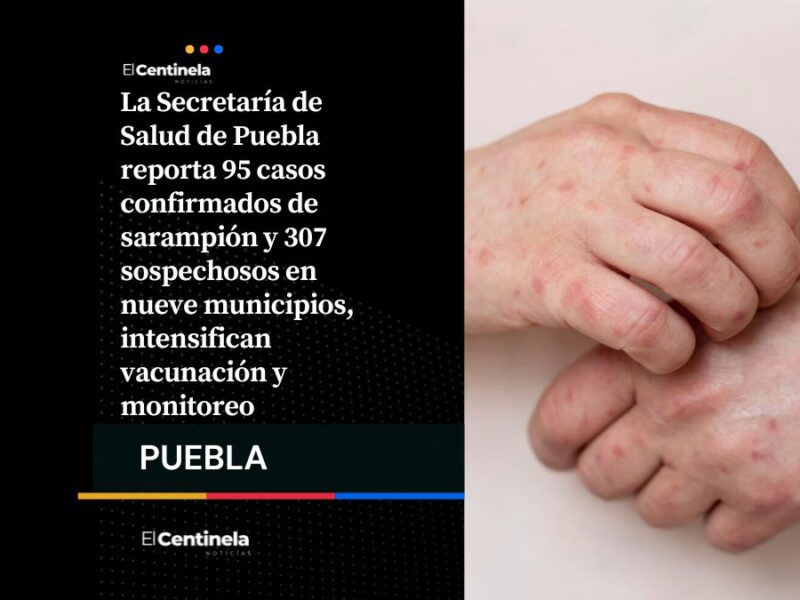 Brote de sarampión en Puebla continúa en aumento 95 casos confirmados y 307 sospechosos