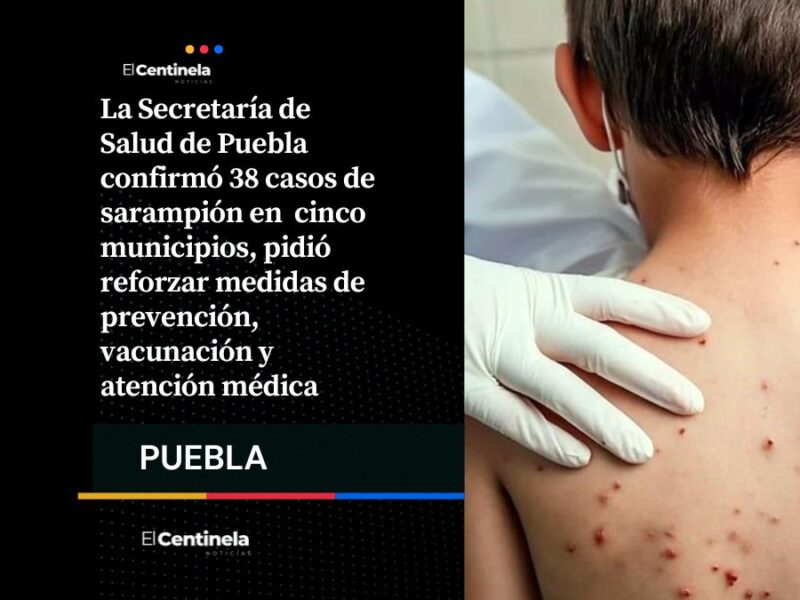 Secretaría de Salud ratifica 38 casos de sarampión en cinco municipios de Puebla