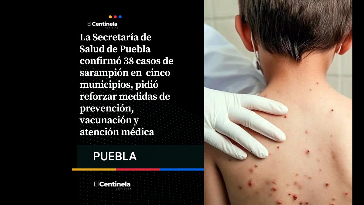 Secretaría de Salud ratifica 38 casos de sarampión en cinco municipios de Puebla