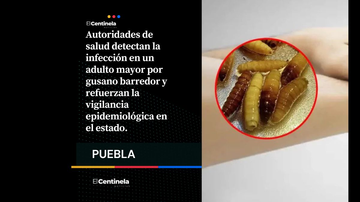 Secretaría de Salud confirma primer caso de gusano barrenador en humano en Puebla