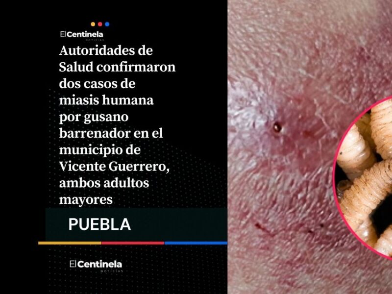 Salud Puebla confirma dos casos de gusano barrenador, pacientes están hospitalizados