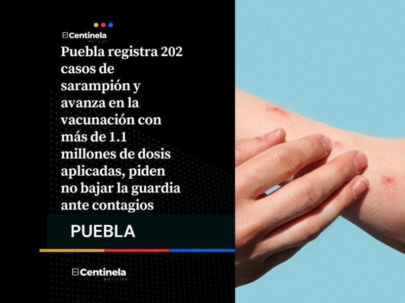 Sarampión en Puebla: 202 casos confirmados y más de 1.1 millones de vacunas aplicadas