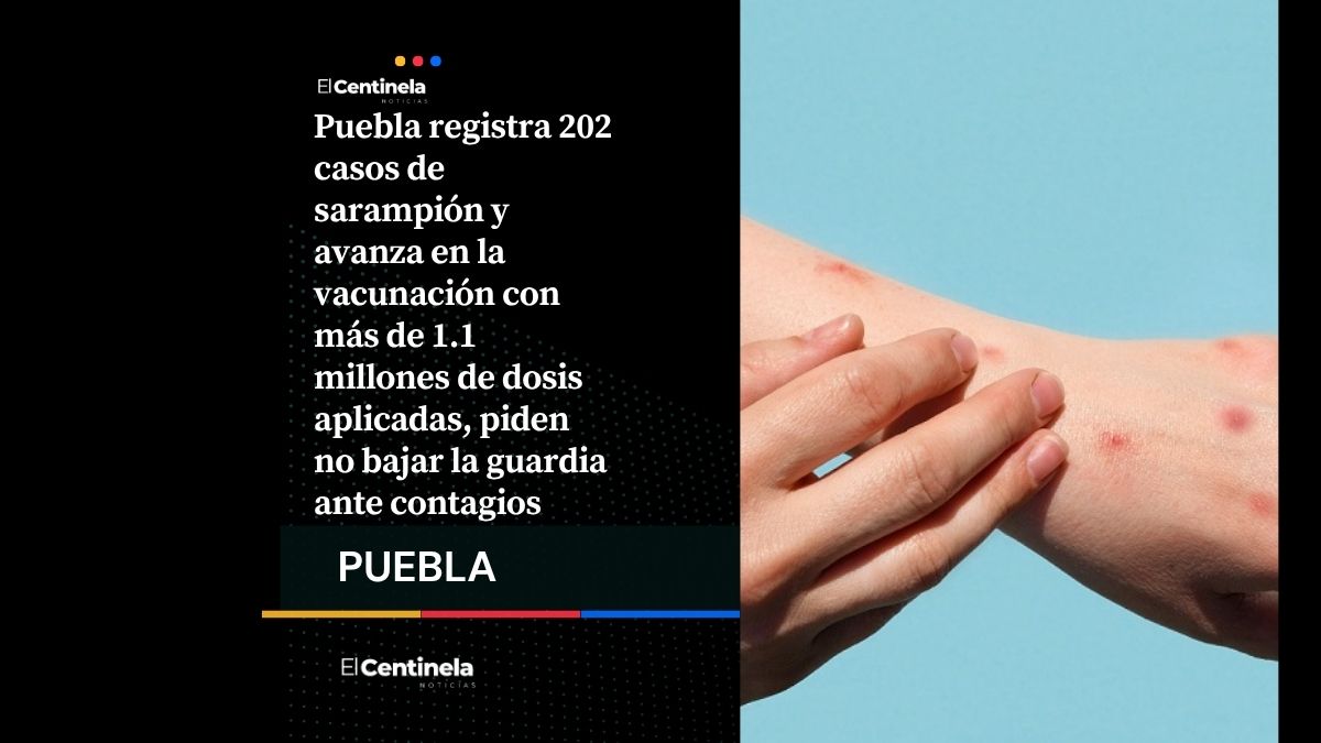Sarampión en Puebla: 202 casos confirmados y más de 1.1 millones de vacunas aplicadas