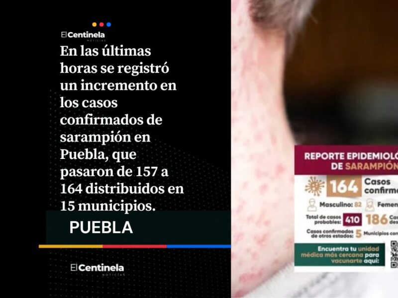 Repunte en Puebla: Confirman 164 casos de Sarampión en 15 municipios