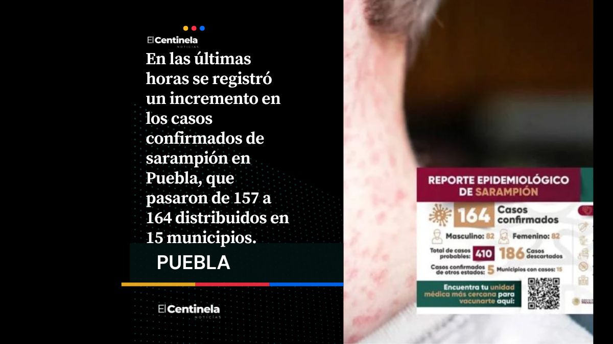 Repunte en Puebla: Confirman 164 casos de Sarampión en 15 municipios