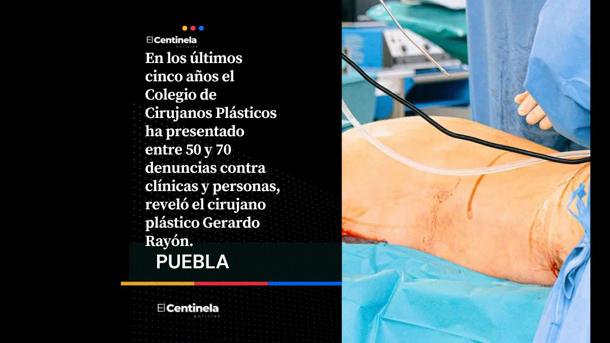 Cirujano plástico alerta sobre clínicas clandestinas y explica cómo verificar a un especialista certificado